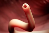 An illustration of a smooth pink worm with an open mouth with jagged teeth against a pink receding background.