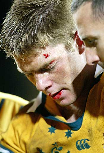 Wallabies overcome bruising Islanders - ABC News