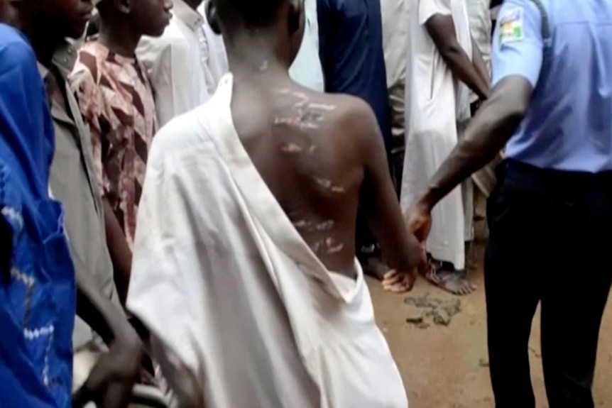 A boy being led away by a police officer has scars across his back.