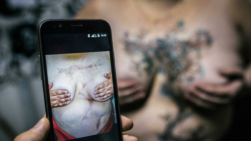 Tattoos cover horrific scars from a domestic violence attack.