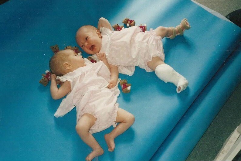Two babies lie side by side in pale pink outfits. One of the babies has her leg in a cast and the other one strapped.