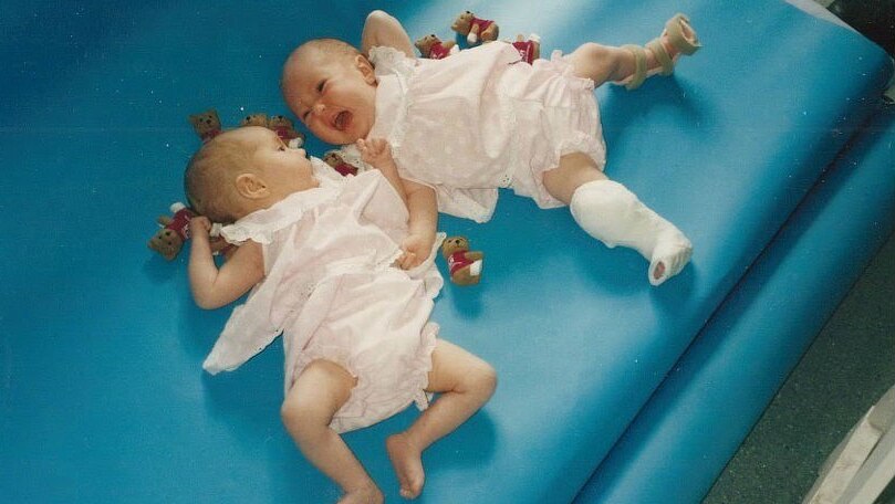 Two babies lie side by side in pale pink outfits. One of the babies has her leg in a cast and the other one strapped.