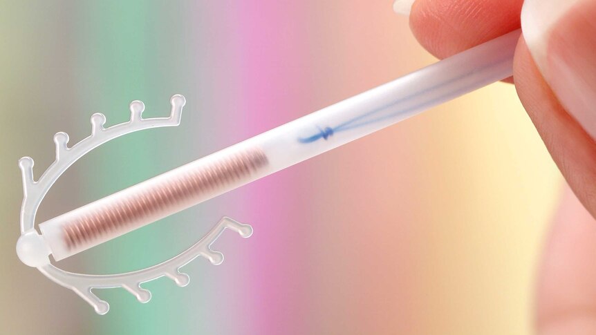 An IUD birth-control device