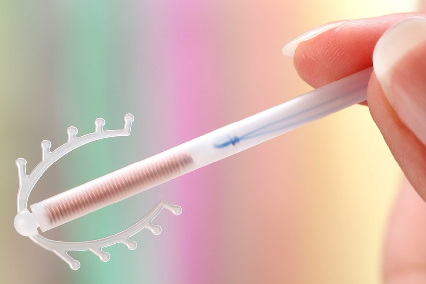 An IUD birth-control device