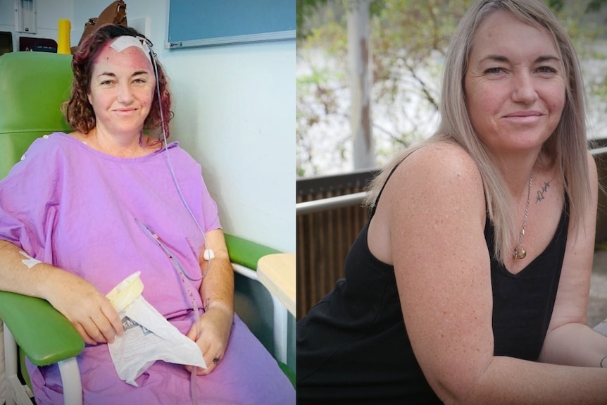 Woman sits in hospital gown with a bandage on her head, next to another photo of herself leaning on a railing smiling outdoors