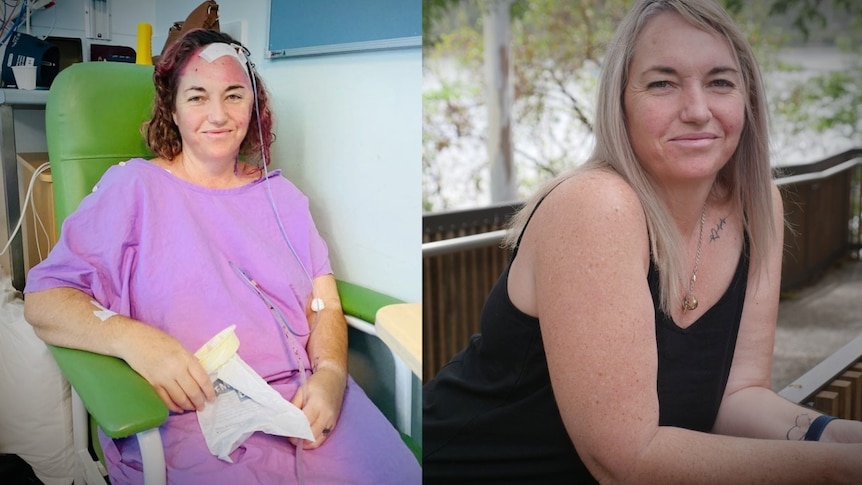 Woman sits in hospital gown with a bandage on her head, next to another photo of herself leaning on a railing smiling outdoors