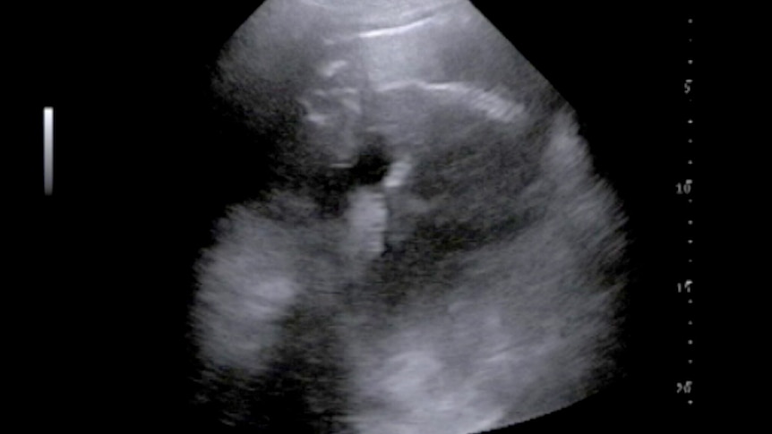 Ultrasound scan of a baby pygmy hippopotamus