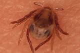 The tick sits on some human skin.