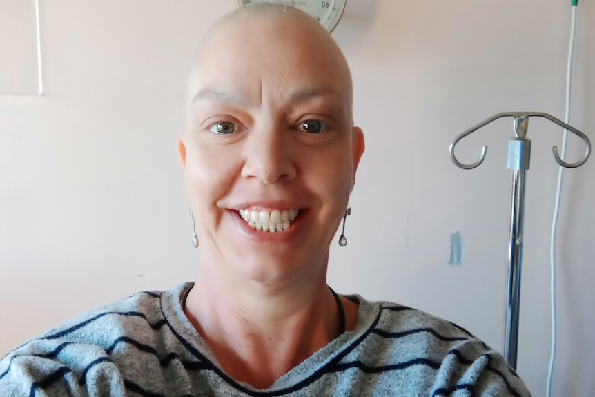 A bald woman smiles at the camera