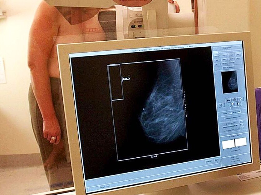 A woman gets her breasts scanned.