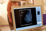 Breast screening results will be checked again