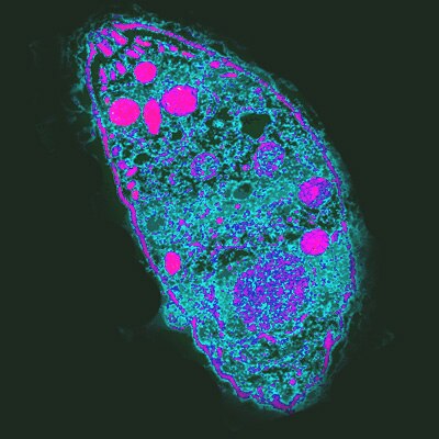 An image of a Toxoplasma Gondii parasite pictured in green, purple and pink 