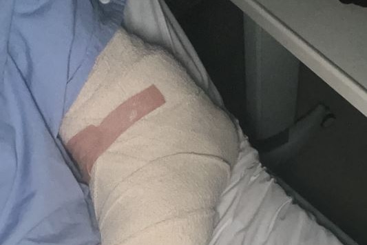 A man's heavily bandaged arm.