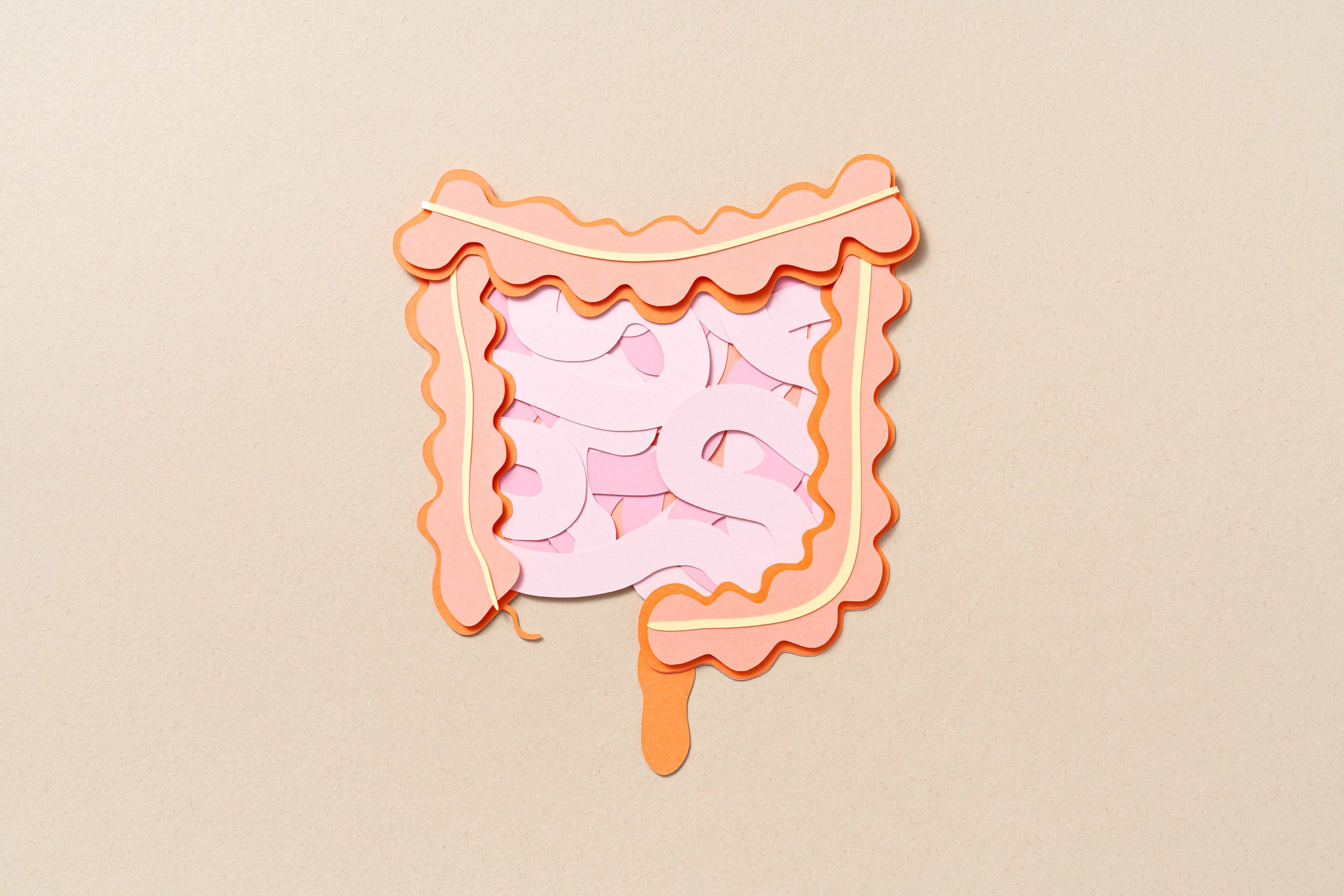 More young people are suffering from bowel cancer