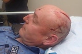 A police officer with an open wound on his head sits on a hospital bed.