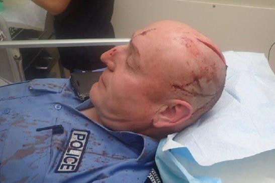 A police officer with an open wound on his head sits on a hospital bed.