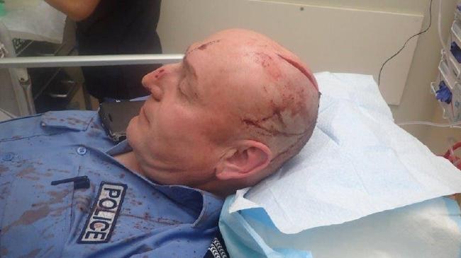 A police officer with an open wound on his head sits on a hospital bed.