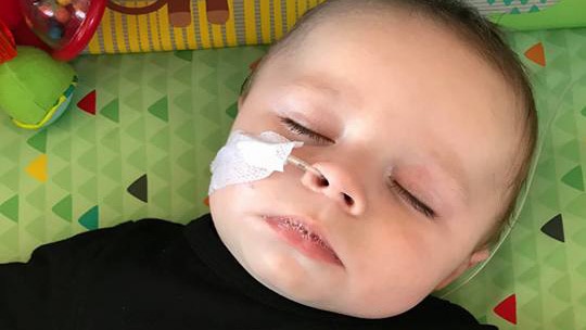 Close-up of a baby with a nasal cannula lying on a rug.,