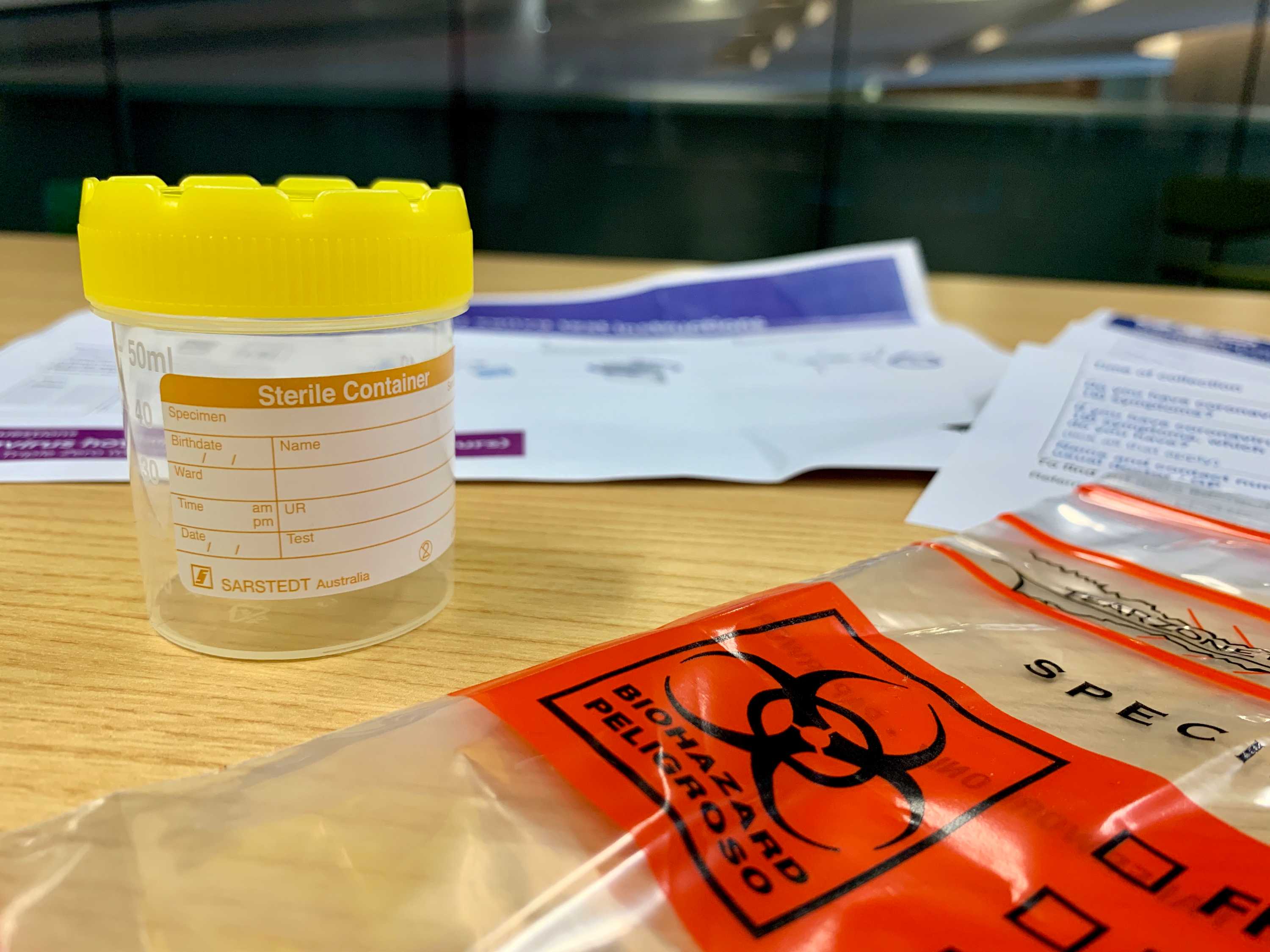 What does the new saliva test for COVID19 involve, how accurate is it