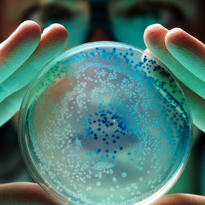 Researcher holds a petri dish with E. coli bacteria showing