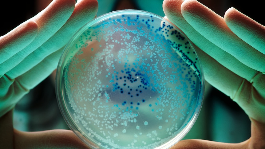 Researcher holds a petri dish with E. coli bacteria showing