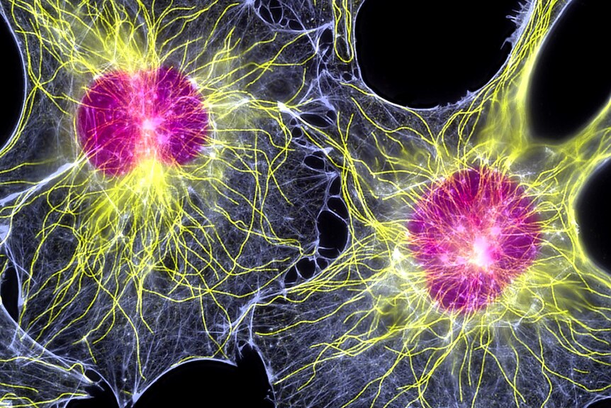 Electron microscope image of two fibroblasts (skin cells).