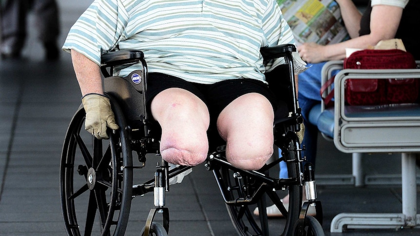 NDIS rollout delay for WA