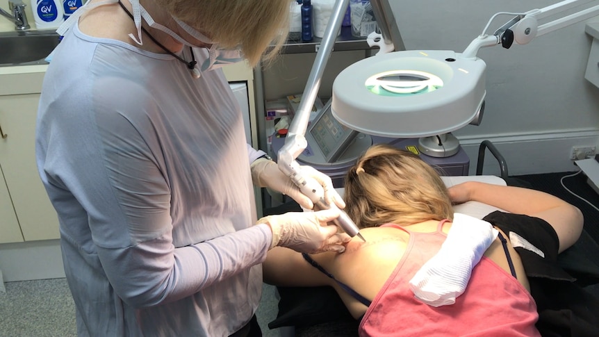 Dr Sue Galligan using a laser to remove a tattoo