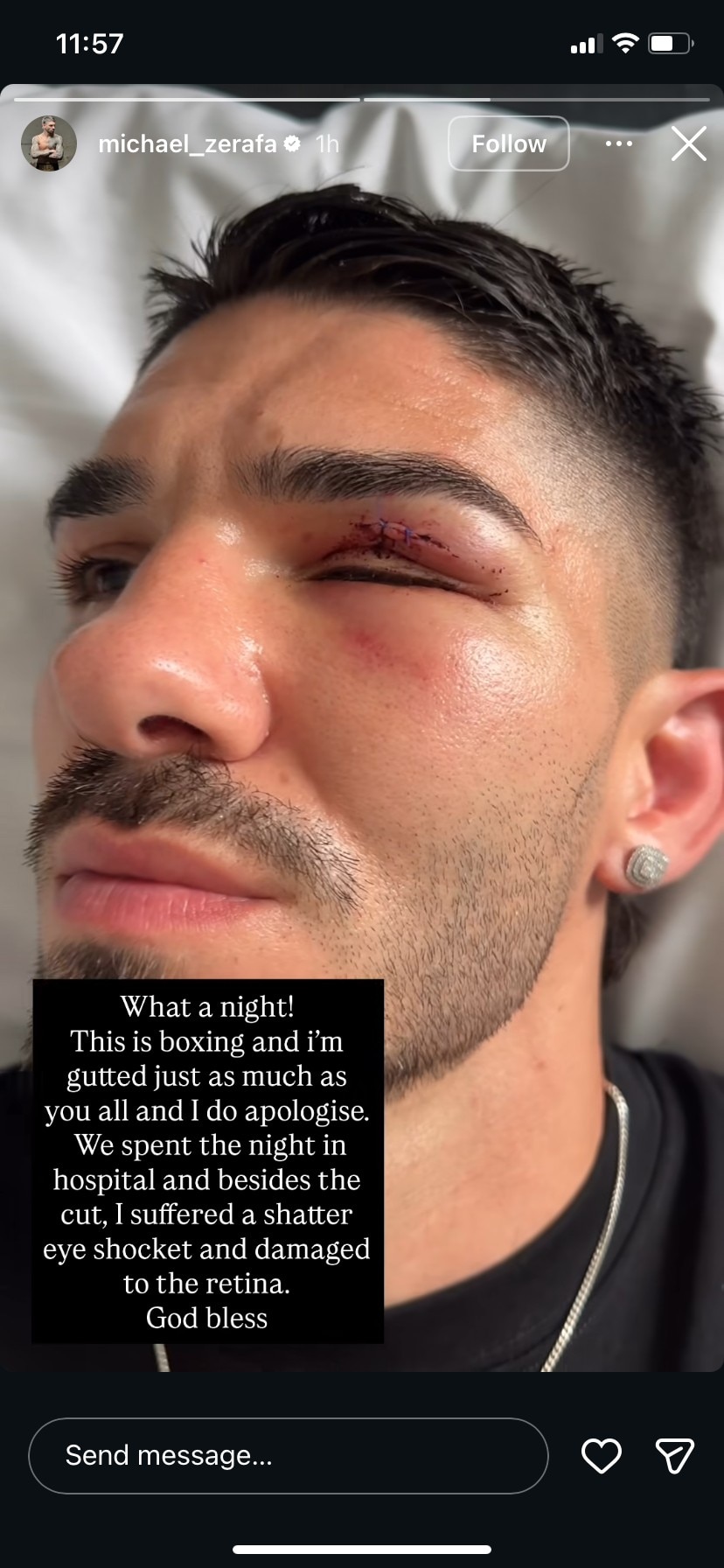 Publicación de Instagram de Michael Zerafa