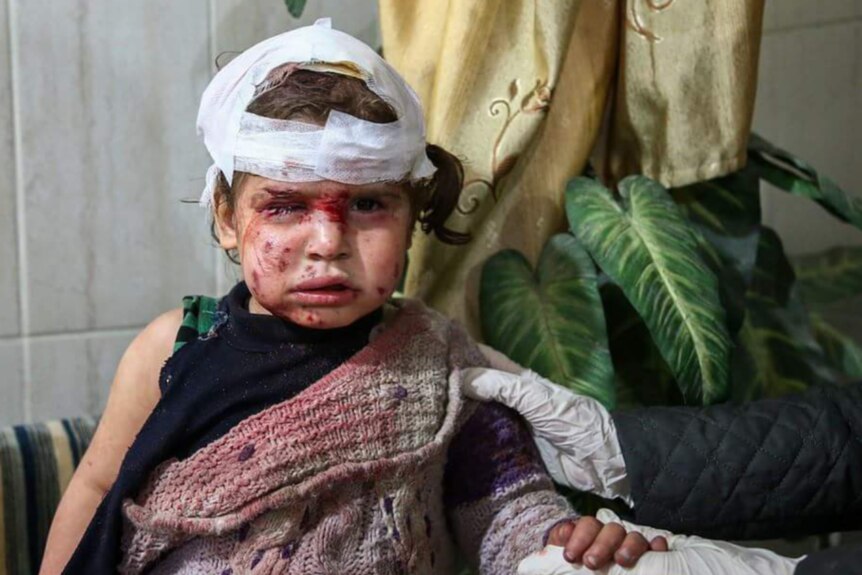 An injured child in Ghouta sits covered in blood and her head bandaged up