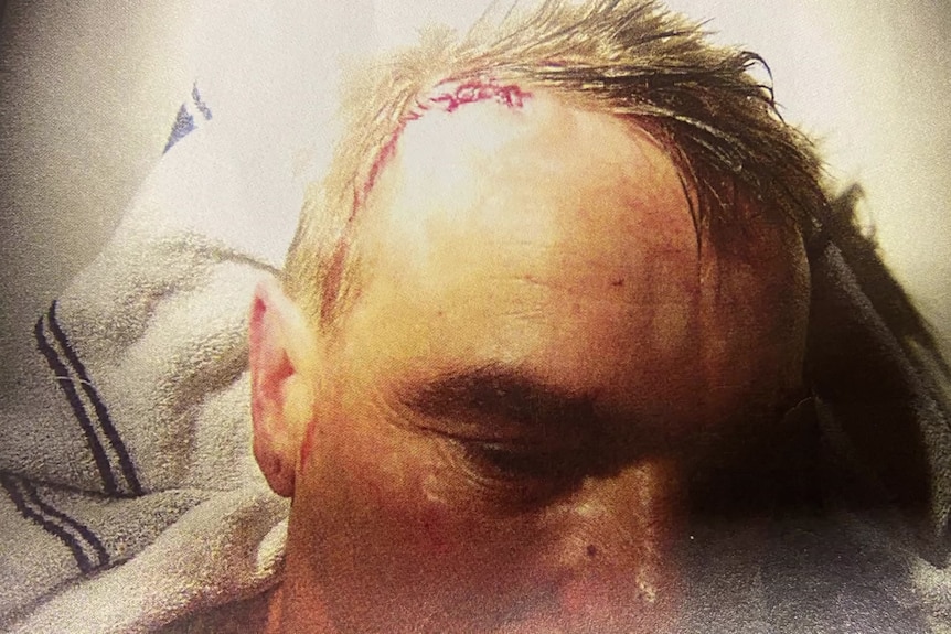 A close-up of the injury sustained by a man while in police custody.