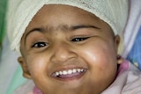 Surgeons have started a marathon operation to separate conjoined twins Trishna (pictured) and Krishn