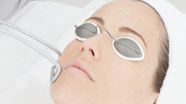 Woman undergoes laser treatment.