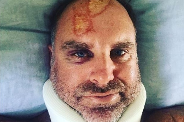 An injured Matthew Hayden sports a neck brace in a photo posted to his Instagram.