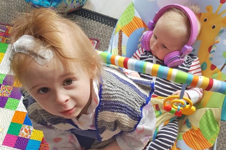 A toddler sits on a baby swing in front of an infant. The toddler has a surgical  dressing on her head.