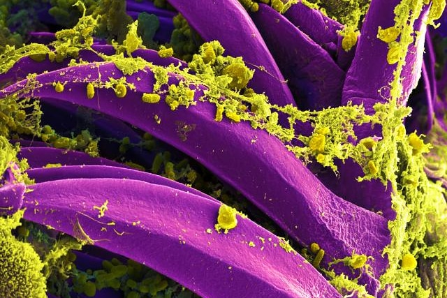 Electron microscope image of Yersinia pestis 