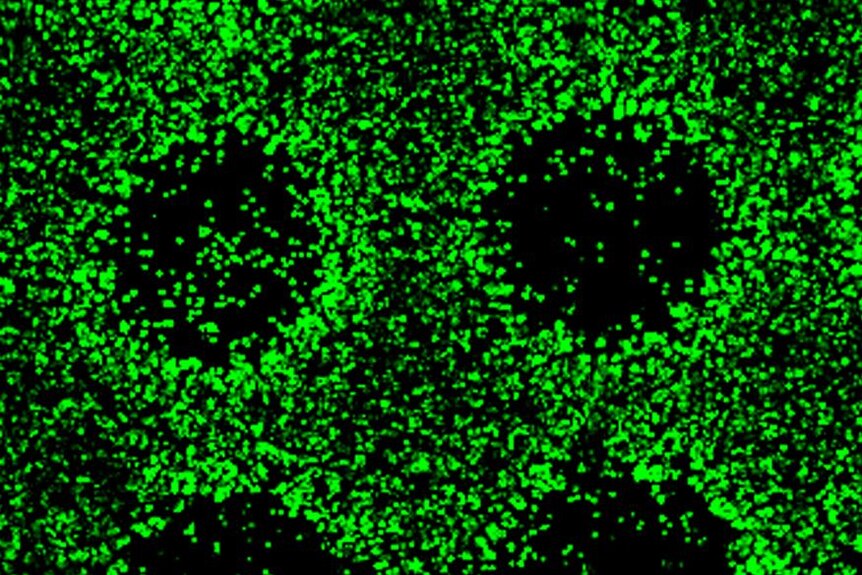 Close up of induced pluripotent stem cells (iPSCs) shown in green