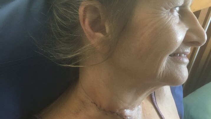 Belinda Bingham has a long scar on her neck