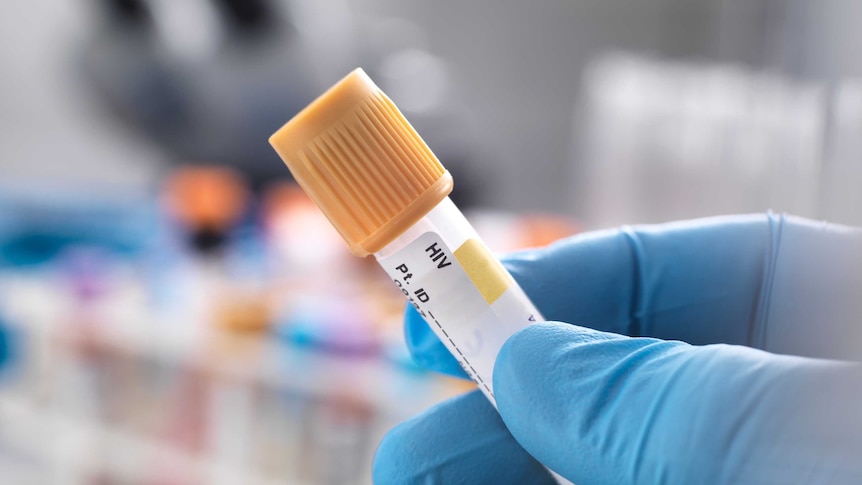 Medical technician preparing a human sample for HIV testing