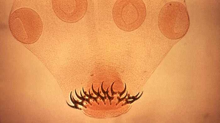 Micrograph image showing the head of a Taenia solium tapeworm, with its four suckers and two rows of hooks.