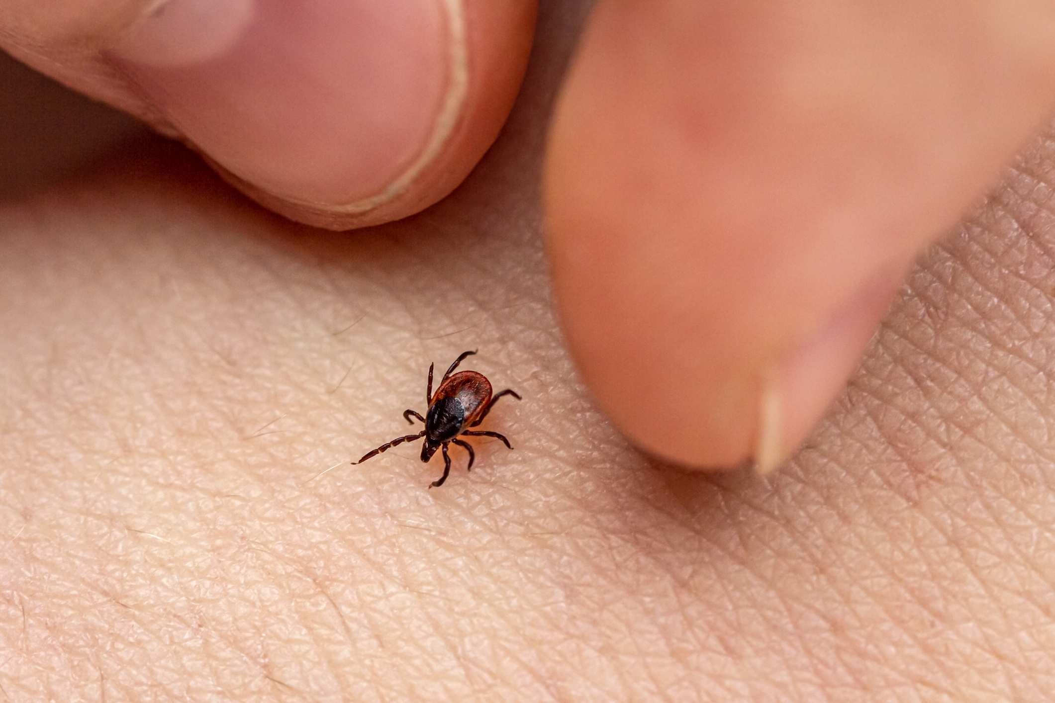 Vaccine rates in Indigenous communities; the origins of The Black Death; understanding illness caused by ticks; and the trial of Theranos founder begins