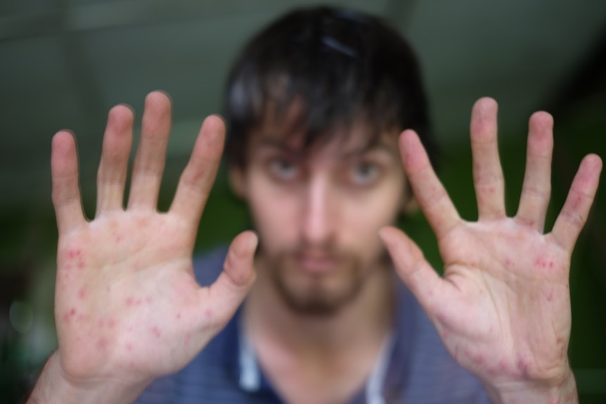 Andrew Gaskell after August trek through Sarawak forest.