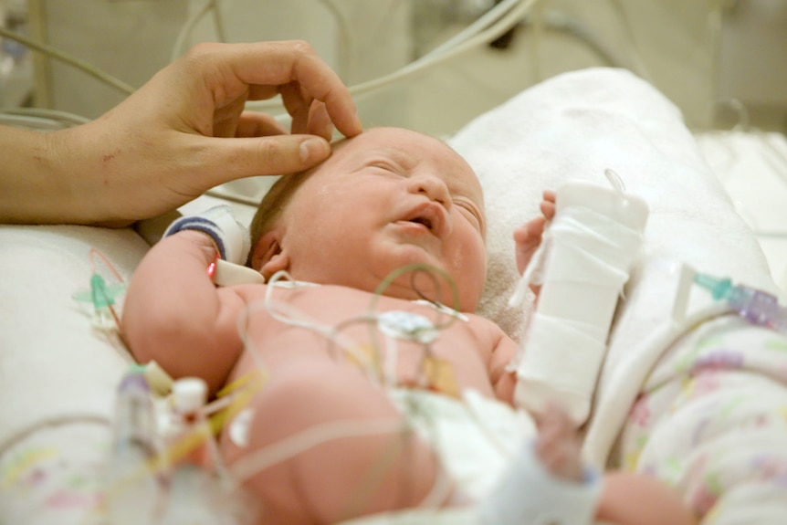 A baby crying in a hospital crib, covered in wires as she's stroked by an adult's hand