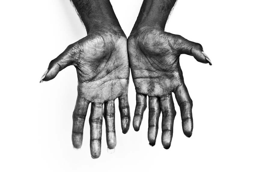 Stretched out hands of Dr G Yunupingu