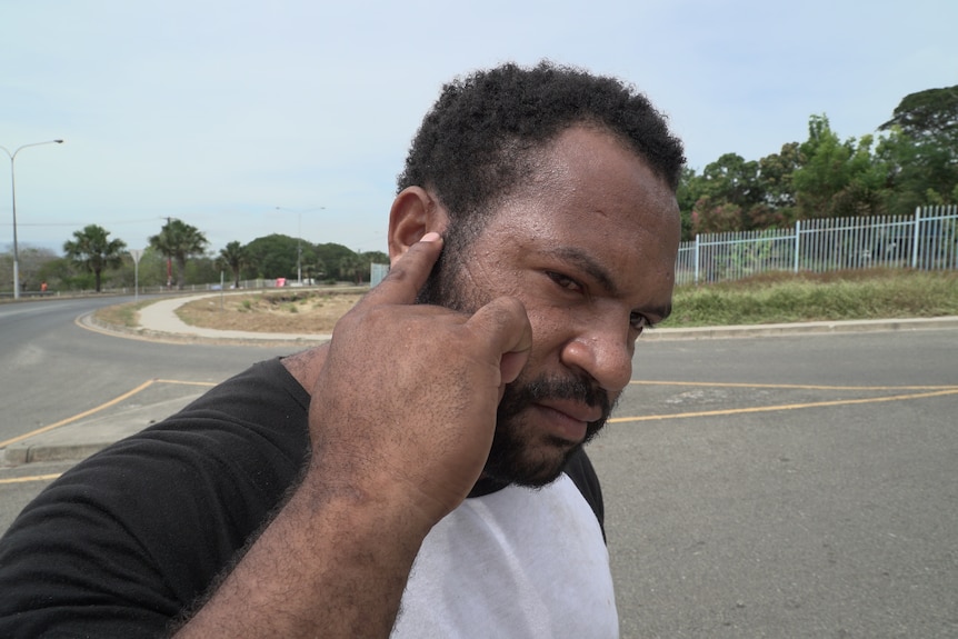 Steven Likas points to a scar on his face from an attack