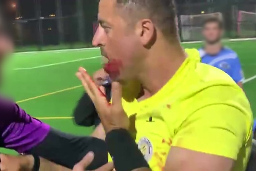 a man with a bleeding mouth on a sports field