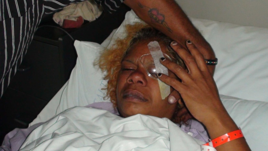 Sheila Oakley underwent surgery after being hit in the eye by a police Taser