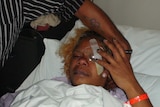Sheila Oakley underwent surgery after being hit in the eye by a police Taser