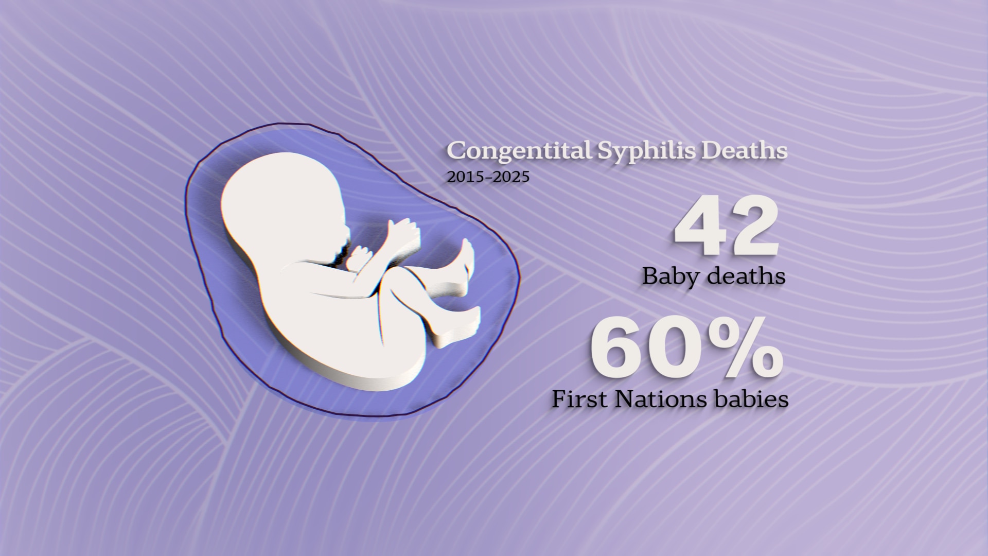 Stats related to syphilis, including the 42 Australian babies who died and the fact 60 per cent of them were First Nations.