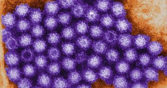 A purple rendering of a colony of norovirus against a brown to yellow background.